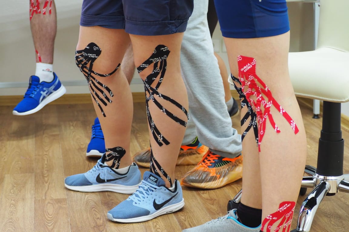 Кинезиотейпирование